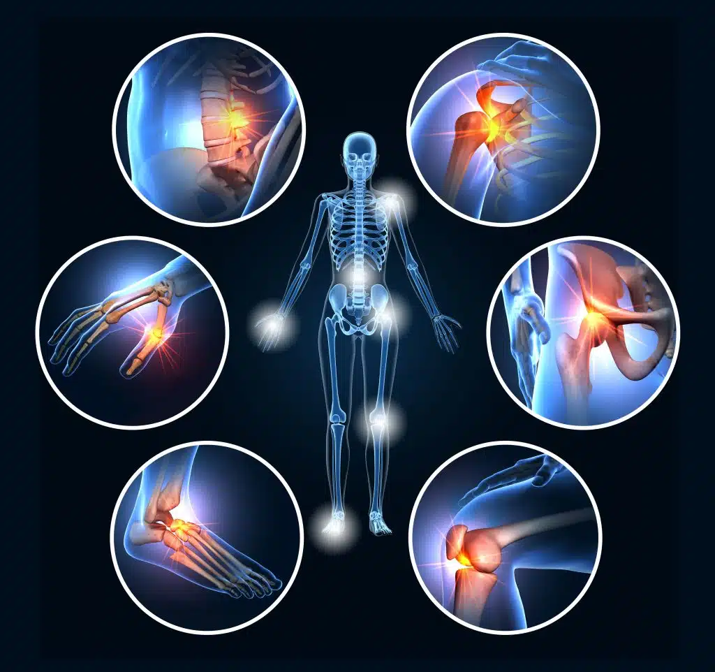 Chronic pain treatment by healyos 6450ea8dc Top 10 Benefits of Physiotherapy for Chronic Pain Relief