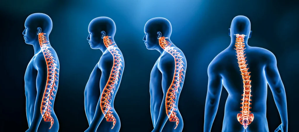 Understanding Upper Back Pain: Causes, Symptoms, and Solutions 6 GetPaidStock.com 67da9cc103999 Understanding Upper Back Pain: Causes, Symptoms, and Solutions