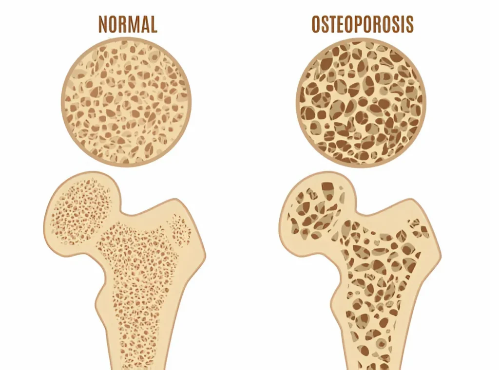 What’s Triggering Your Back Pain? Key Explanations and Solutions 4 GetPaidStock.com 67e1116469da7 What’s Triggering Your Back Pain? Key Explanations and Solutions