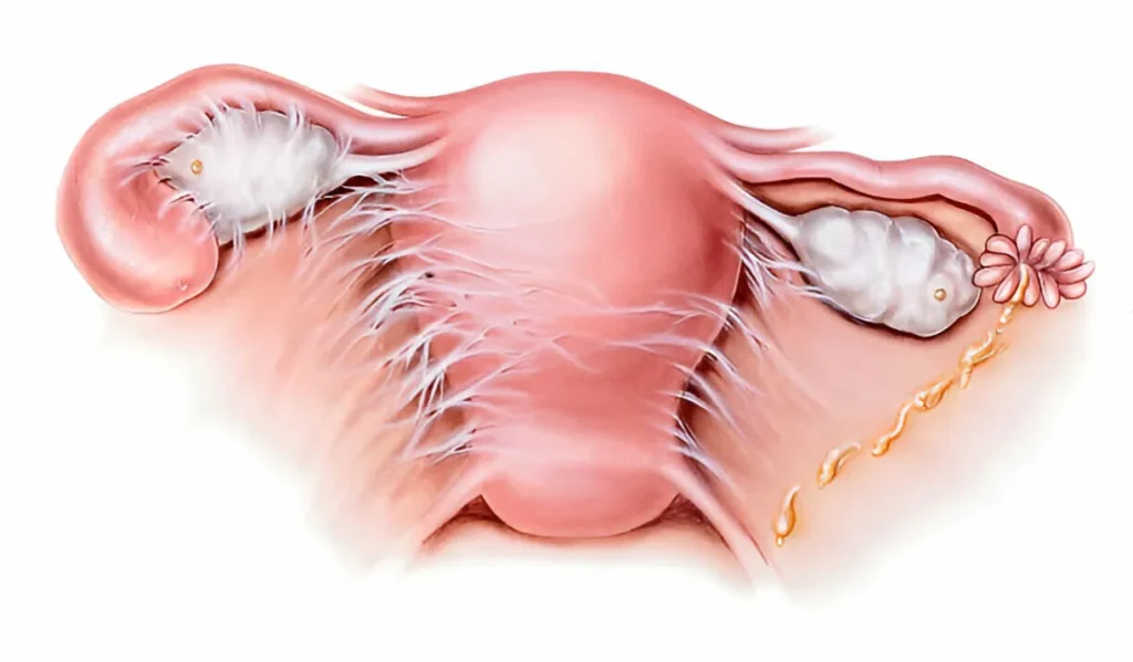 What’s Triggering Your Back Pain? Key Explanations and Solutions 8 GetPaidStock.com 67e113cb2724e What’s Triggering Your Back Pain? Key Explanations and Solutions