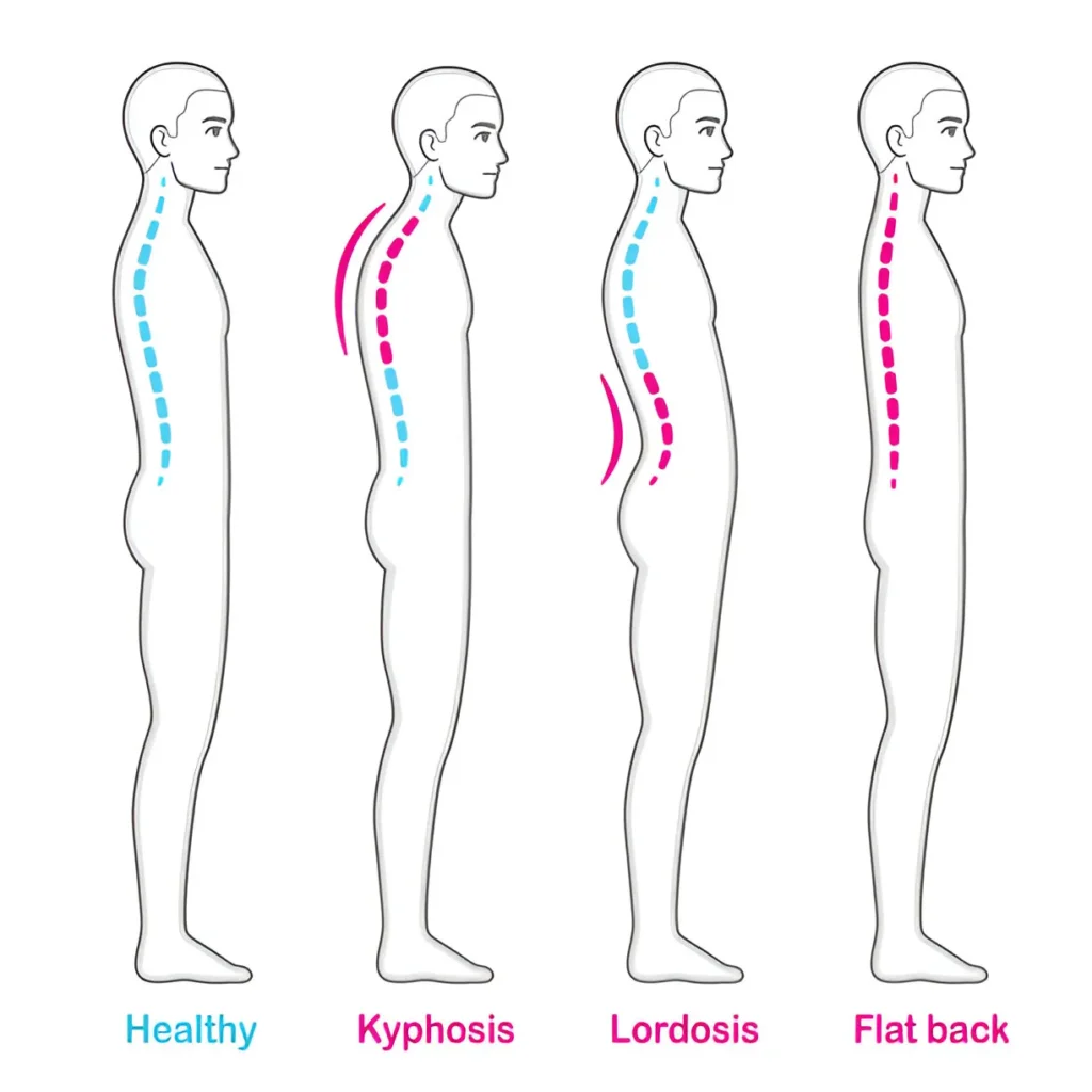 steptodown.com363973 Physical Examination Techniques for Diagnosing Back Pain