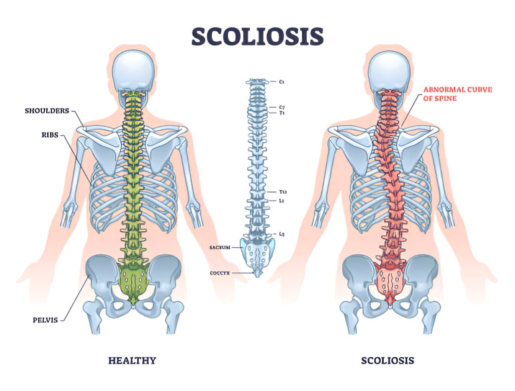steptodown.com525682 1 Middle Back Pain: Causes, Treatment, and Expert Care
