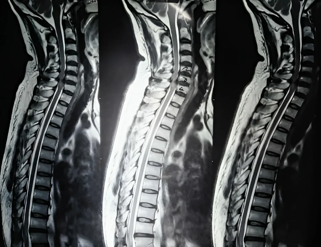 GetPaidStock.com 6808a13d51c49 Understanding the Difference Between Spondylosis and Spondylitis